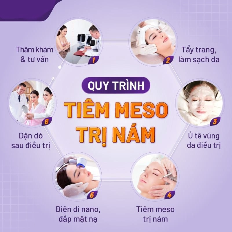 tiem-meso-tri-nam-3